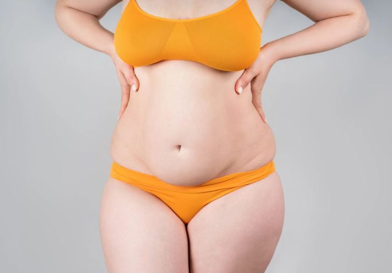 Read more about the article What Is a Mini Tummy Tuck For?