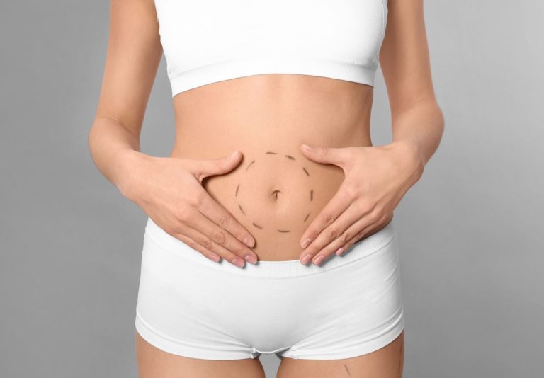 Read more about the article Who is Suitable for a Mini Tummy Tuck?